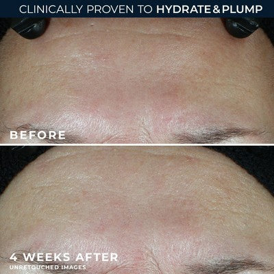 RoC Multi Correxion Hydrate + Plump Daily Moisturizer with Hyaluronic Acid SPF 30 1.7oz - Imperfect Box