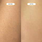 Nood Ingrown Hair Treatment The Eraser - Imperfect Box