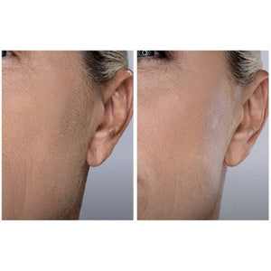 Spa Sciences SIMA Deluxe Sonic Dermaplaning Tool for Exfoliation & Peach Fuzz Removal