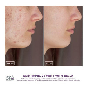 Spa Sciences BELLA 3-in-1 Diamond Tip Microdermabrasion System - New