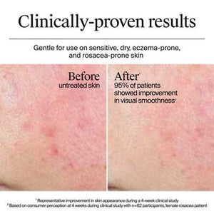 Neutrogena Hydro Boost Water Face Cream for Extra-Dry and Acne-Prone Skin 1.7 fl oz - Imperfect Box