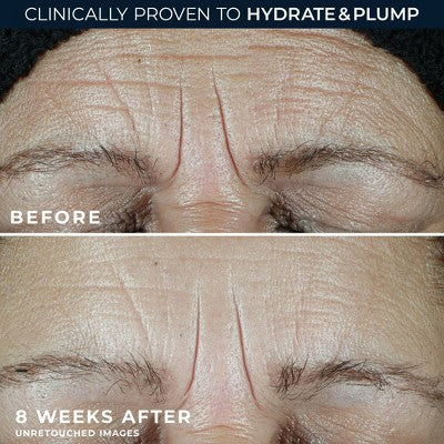 RoC Multi Correxion Hydrate + Plump Daily Moisturizer with Hyaluronic Acid SPF 30 1.7oz - Imperfect Box