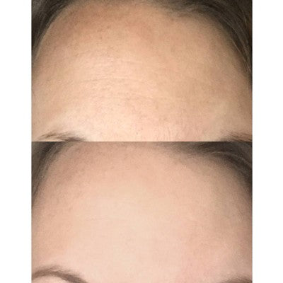 derma e Pure Biome Face Moisturizing Cream 2 fl oz - New