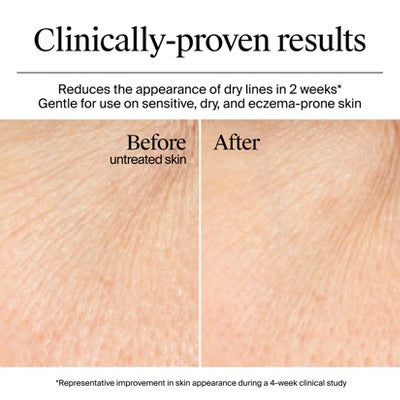 Neutrogena Hydro Boost Water Gel Cream Moisturizer 1.7 fl oz - Imperfect Box