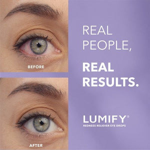 Lumify Eye Drops for Redness Relief 2.5ml - New