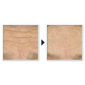RoC Face & Neck Anti-Aging Moisturizer Firming Cream for Crepey Skin 1.7 fl oz - Imperfect Box