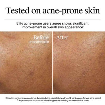 Neutrogena Hydro Boost Water Gel Cream Moisturizer 1.7 fl oz - Imperfect Box